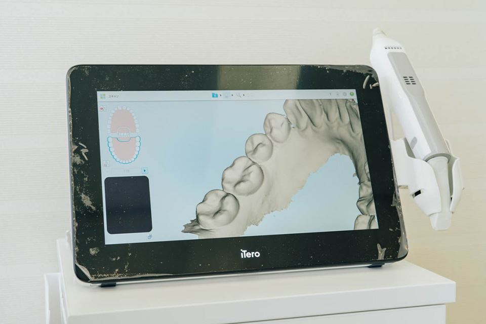 3Dシミュレーションで治療後の歯並びを事前に確認